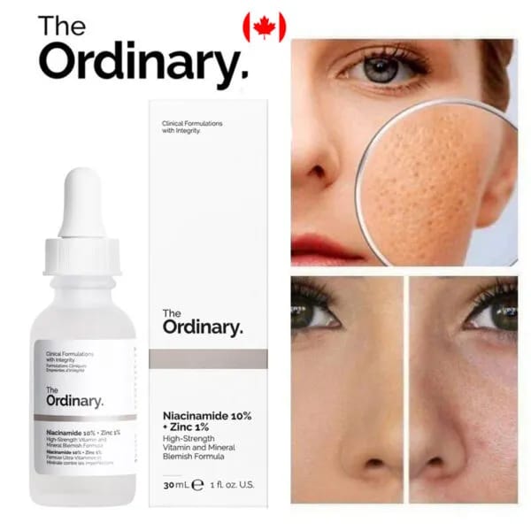 The Ordinary Vitamin C Serum(30ML)
